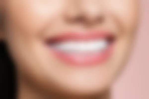 限时促销！仅需2500元起，杭州余杭泽一口腔门诊部的烤瓷牙原价3000元起，优惠不容错过！