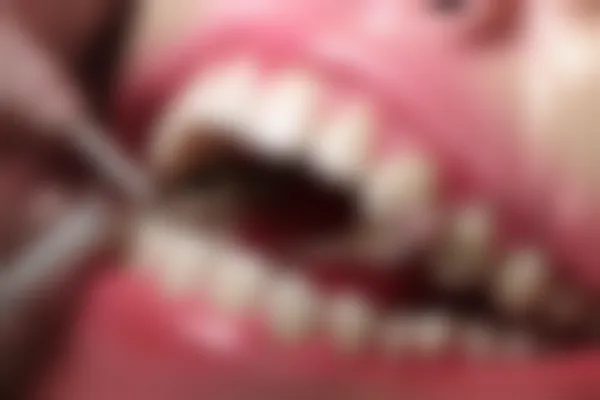 广州柏德口腔门诊部（海珠院区）推出口腔预防保健项目，现仅需299元起，原价388元起，抓住这个难得的机会，快来体验吧！