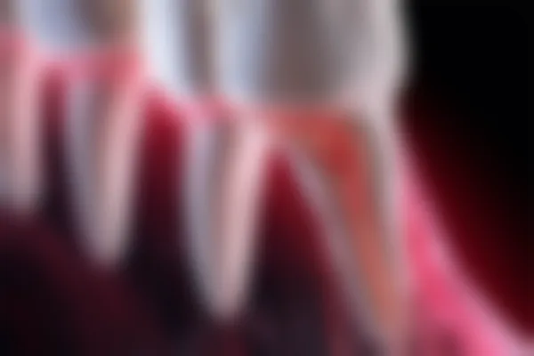 遵义和美口腔门诊部推出牙齿美白优惠活动，原价1880元起现仅需1280元起，助您轻松拥有迷人微笑！