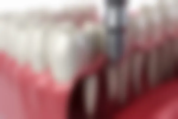 上海尤旦口腔医院位置及种植牙费用解析，真实评价与对比让你明白选择哪家更合适