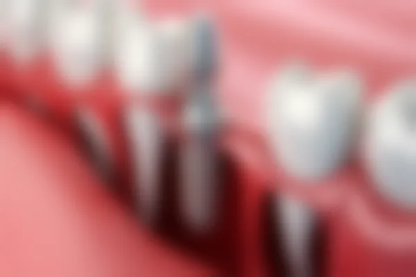 昆明爱齐口腔门诊部洗牙服务现仅需198元起，原价298元起，机会难得，快来体验洁牙服务吧！