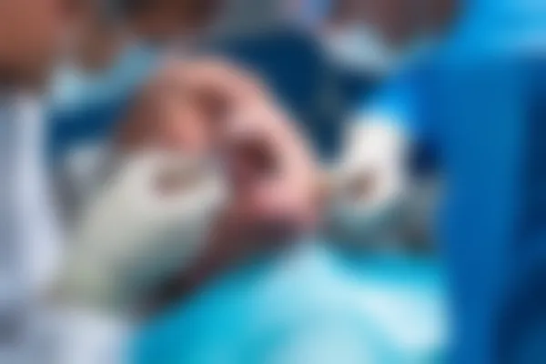 潍坊牙科医院拔牙优惠：原价500元起，现在只需350元起，机会难得，欢迎咨询！
