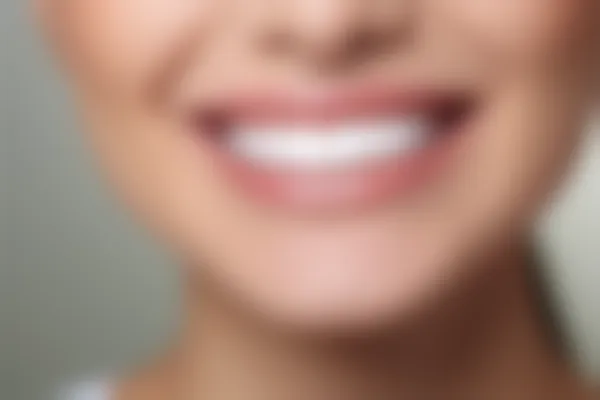 根管治疗后为什么需要进行打桩？打桩的必要性与重要性解析