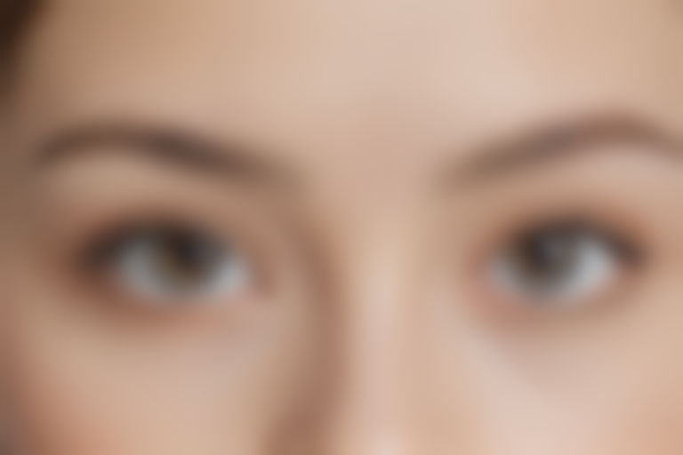 宁德华美整形外科门诊部丰眉弓优惠活动来袭，限时优惠仅需5800元起，原价6800元起，抓住机会，赶快体验吧！