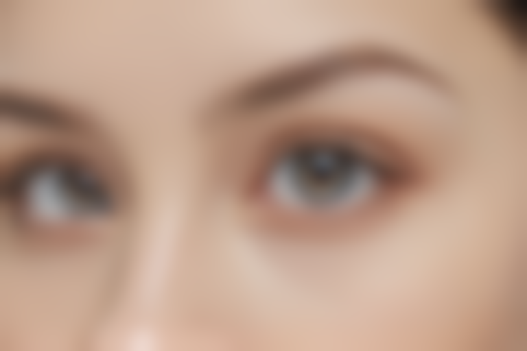 无锡扬名医院整形美容中心微创除皱价目表：原价3000元起，现仅需2500元起，优异优惠，抓紧时间！