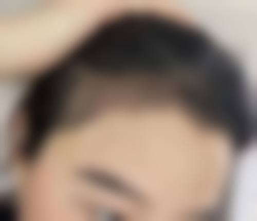 天津熙朵丽尊植发整形医院收费价格表