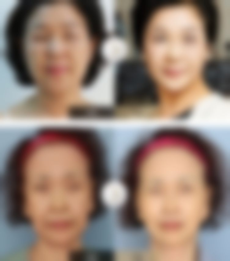 山东菏泽华美医疗美容门诊部特色诊疗项目与技术优势