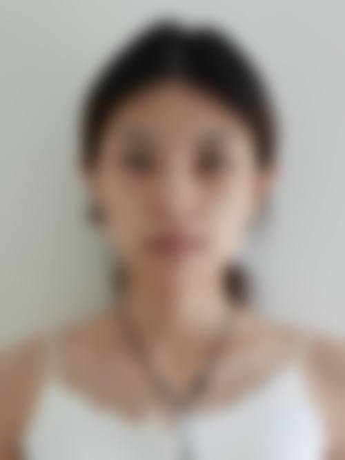 郑州乡南整形美容中 心收费价格表