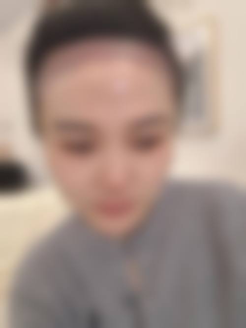 合肥斯尔美丛生植发医院特色诊疗项目与技术优势