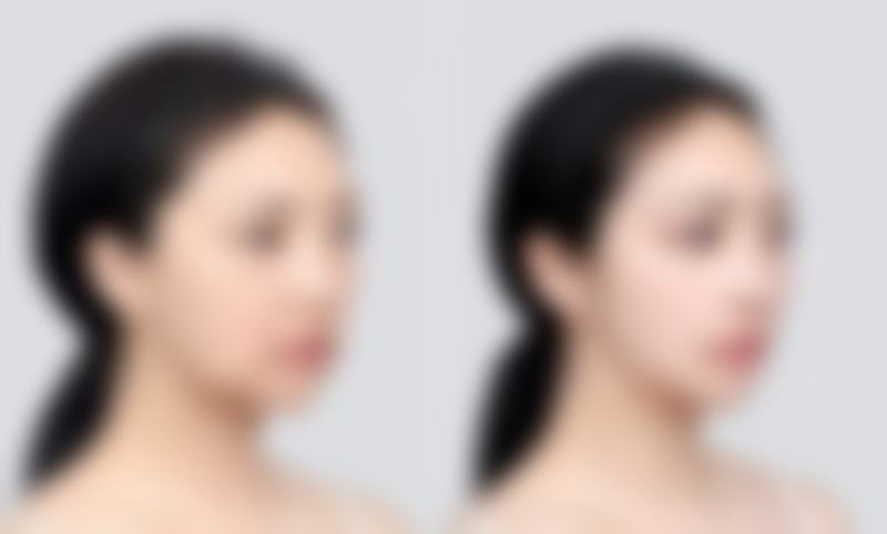 深圳韩佳医疗美容门诊部特色诊疗项目与技术优势