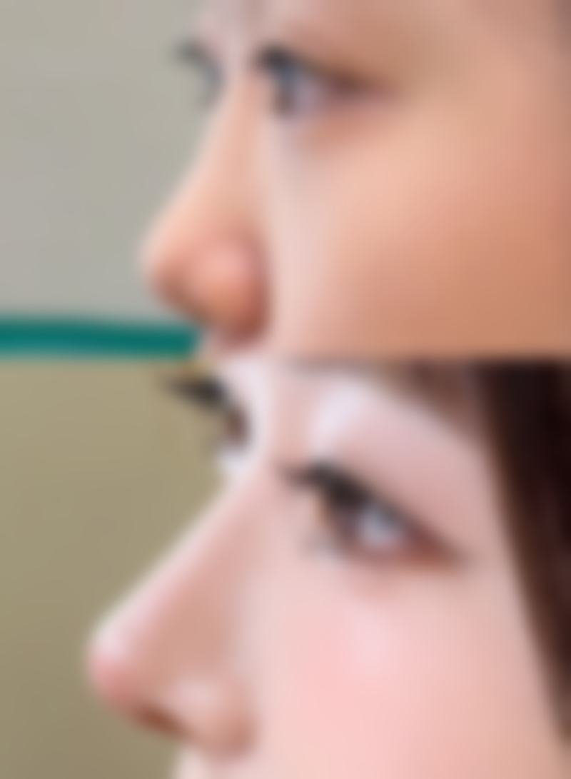 南通崇川富华医疗美容门诊部预约挂号方式