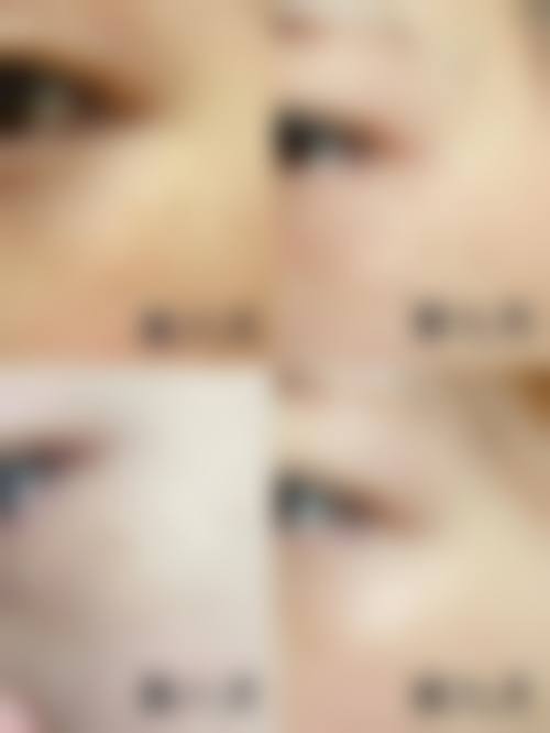 肖燕标医生技术优势