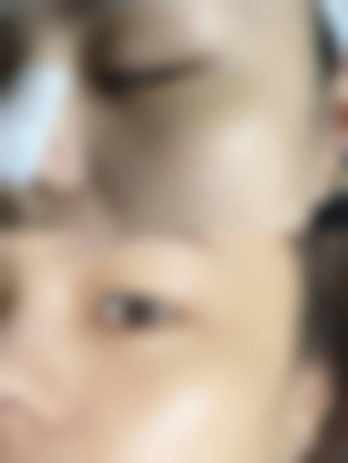 肖燕标医生项目收费价格