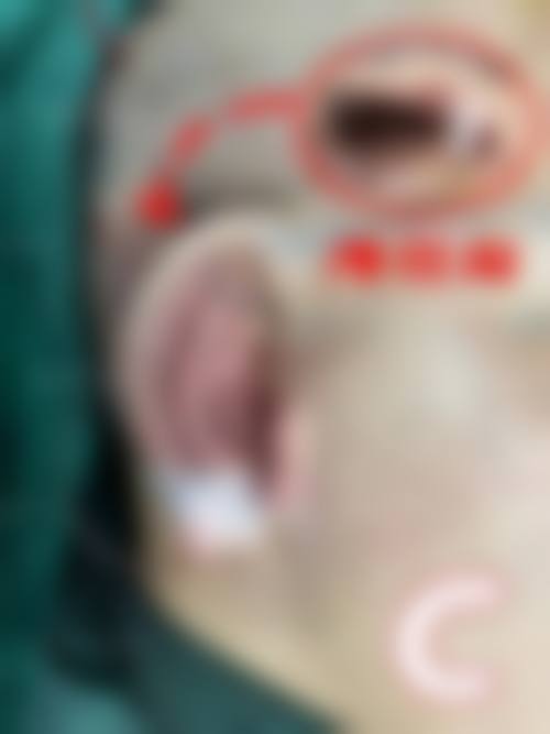 郑州花绽医疗美容诊所收费价格表