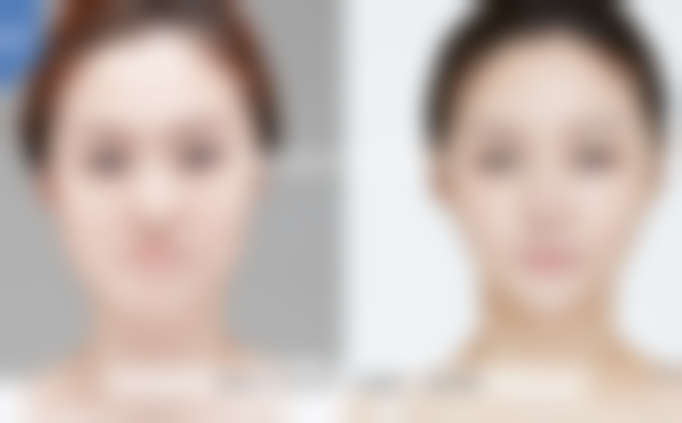 韩国REGEN丽珍整形外科医院医疗环境与配套设施