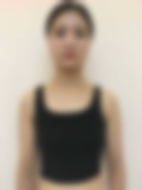 徐斌医生项目收费价格