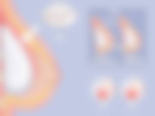 徐斌医生技术优势