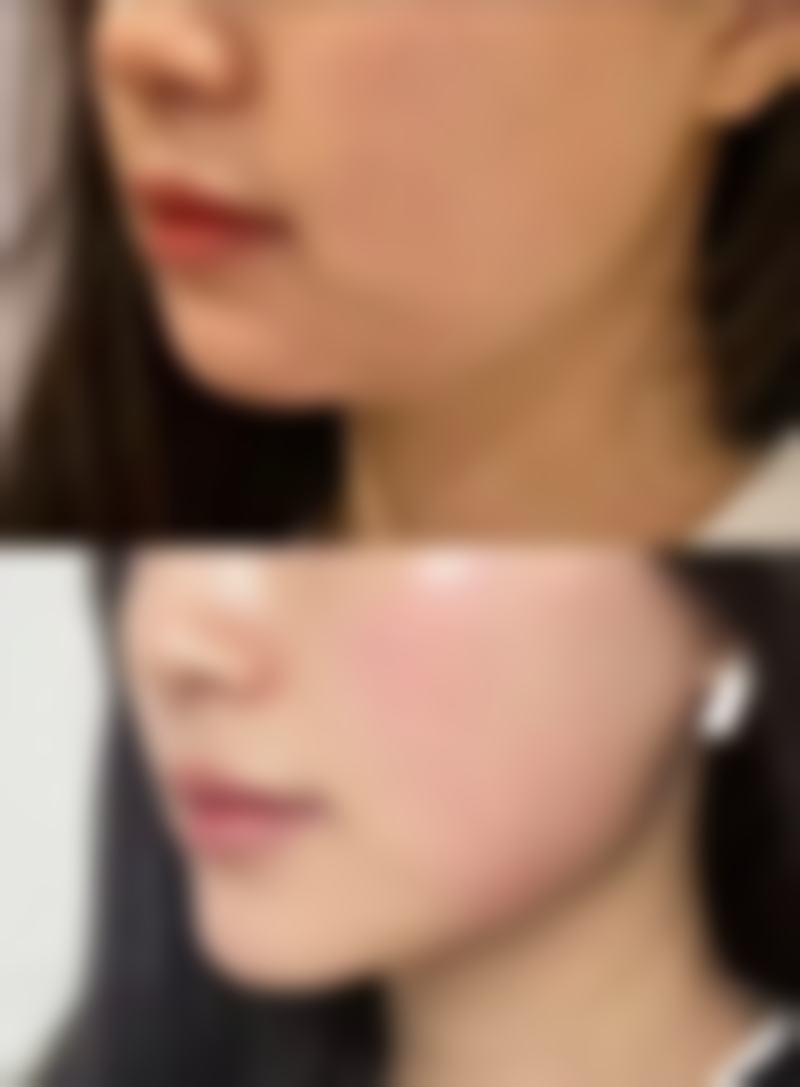 刘申松医生技术优势