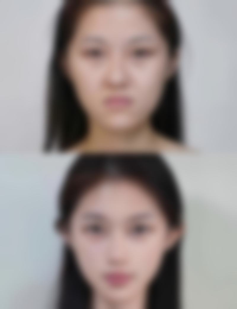 刘申松医生项目收费价格