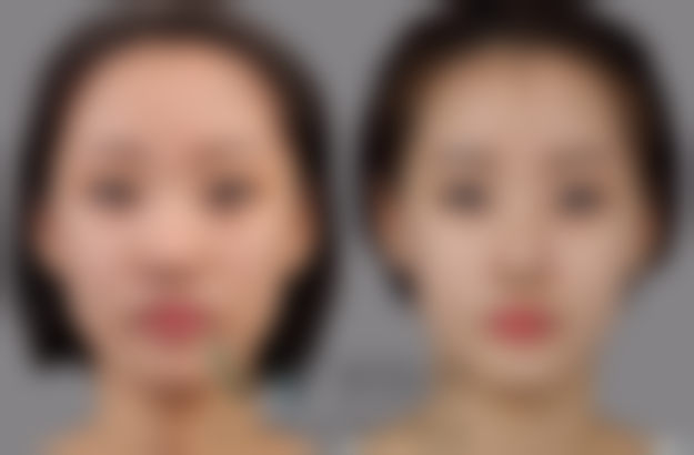 韩国原辰整形外科医院预约挂号方式