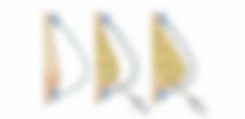 武宏斌医生技术优势