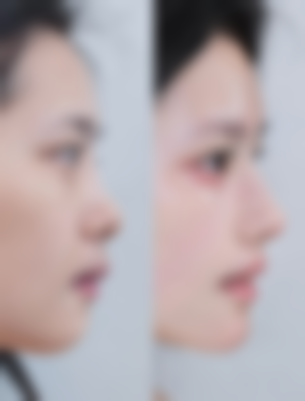 西安颜玖柒整形医院预约挂号方式