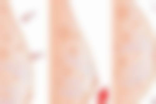 治愈整形外科预约挂号方式