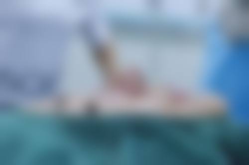 无锡乔森整形医院收费价格表