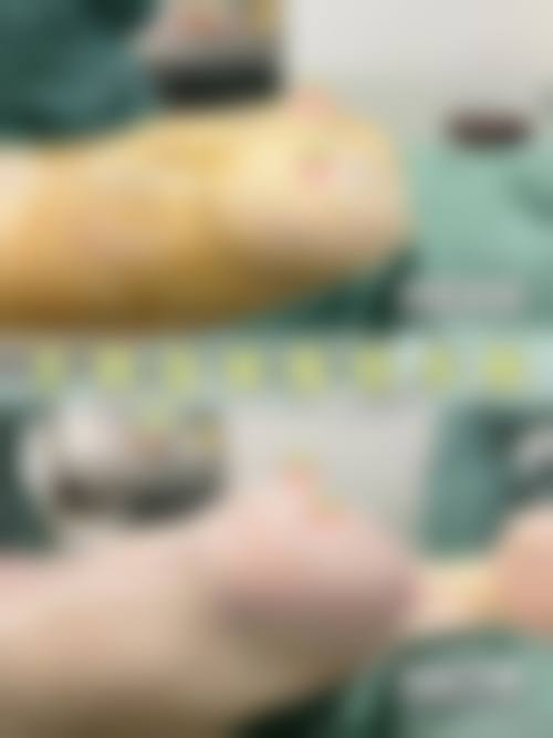 徐斌医生项目收费价格