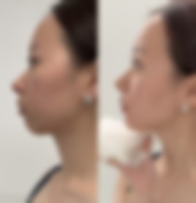 西宁美莱馨怡整形医院预约挂号方式