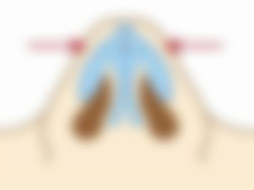 杨立伟医生技术优势