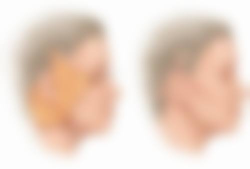 黄圣邓医生口碑评价及反馈内容