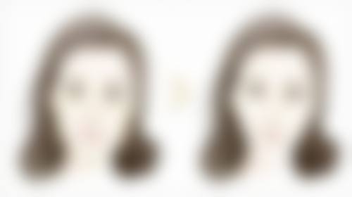 黄圣邓医生技术优势