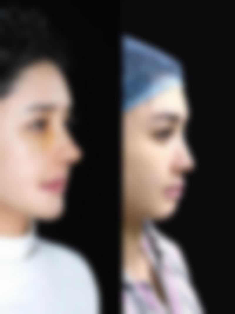 中江熹亚整形医院预约挂号方式