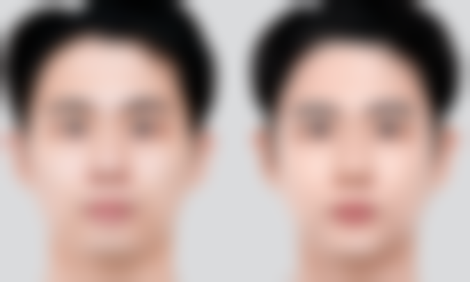 女王医疗美容收费价格表