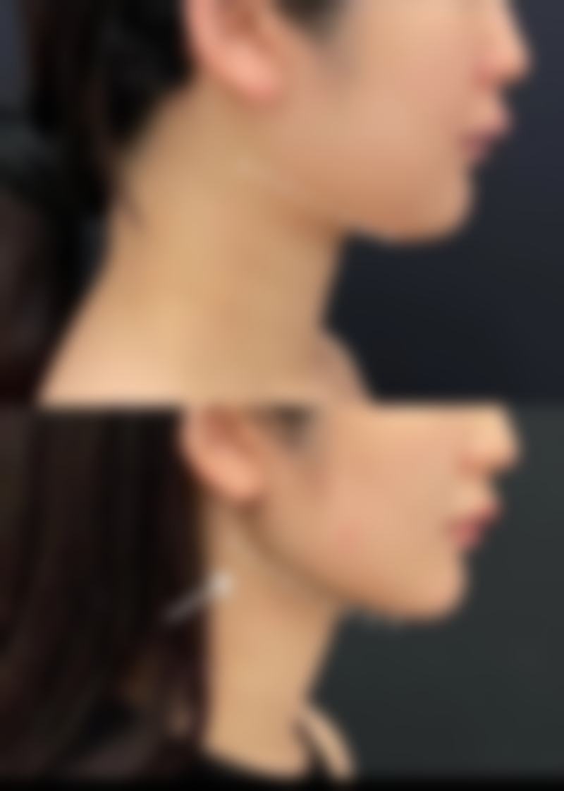 杨立伟医生口碑评价及反馈内容