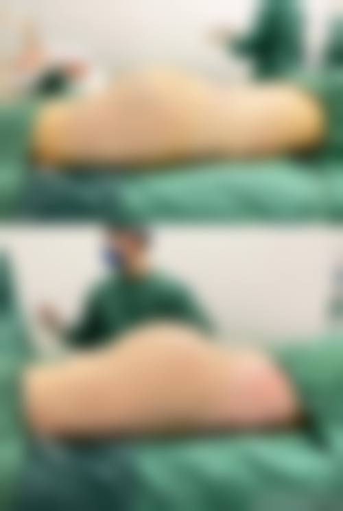 南美英医生项目收费价格