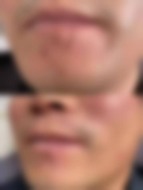 薛宏斌医生口碑评价及反馈内容