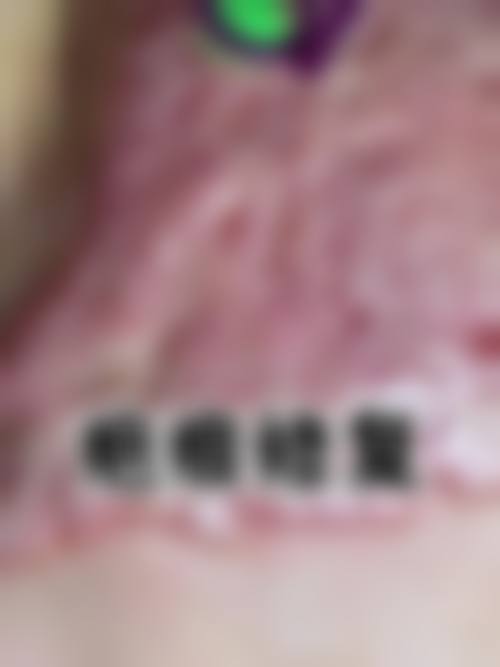 薛宏斌医生技术优势