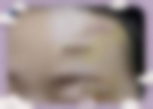 薛宏斌医生项目收费价格