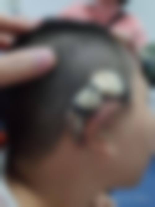 陈子益医生口碑评价及反馈内容