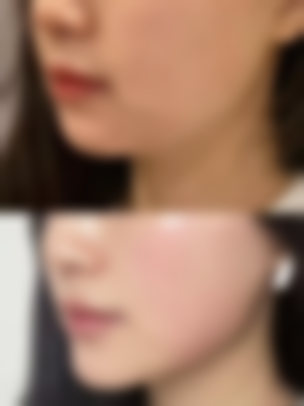 绵阳恩素医疗美容诊所收费价格表