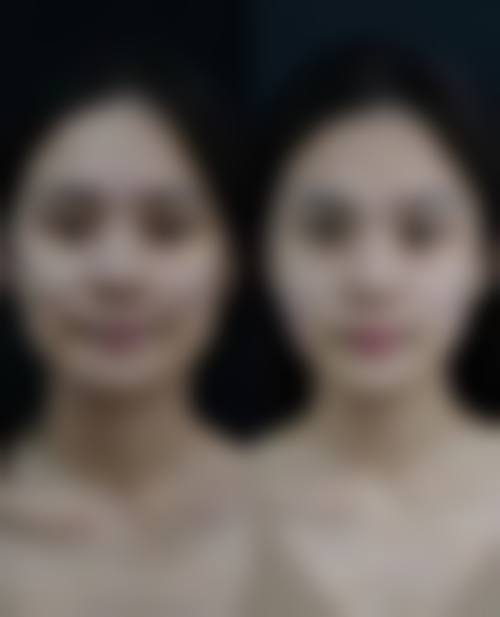 董雷医生项目收费价格