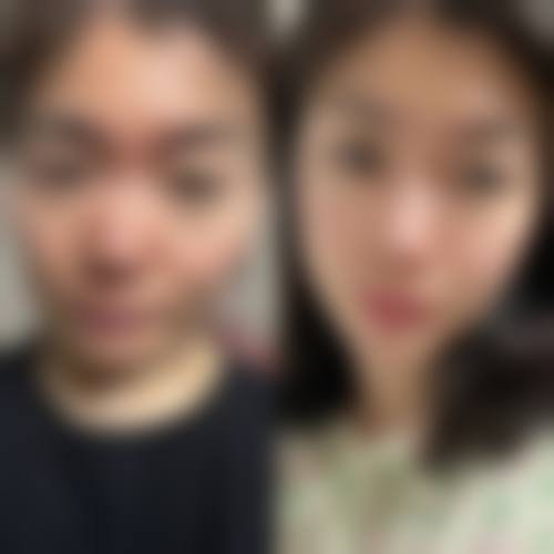 董雷医生技术优势