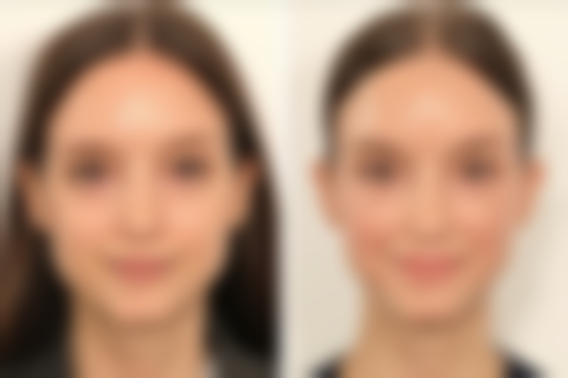 张廷威医生口碑评价及反馈内容