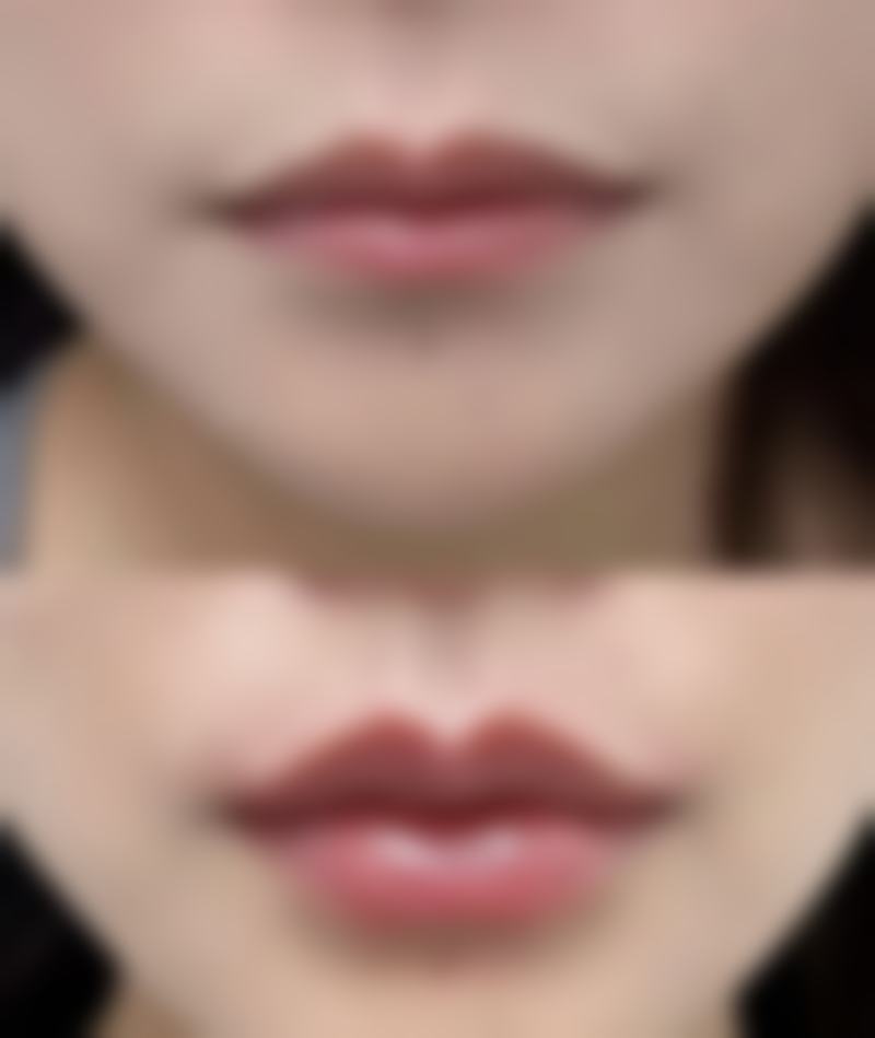 平顶山市第一人民医院孙艳华医生项目收费价格