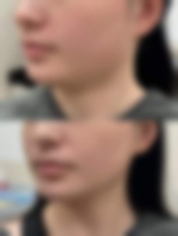 绍兴熙雍美容门诊部收费价格表