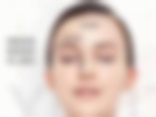 男士利泽医疗脱毛札幌院特色诊疗项目与技术优势