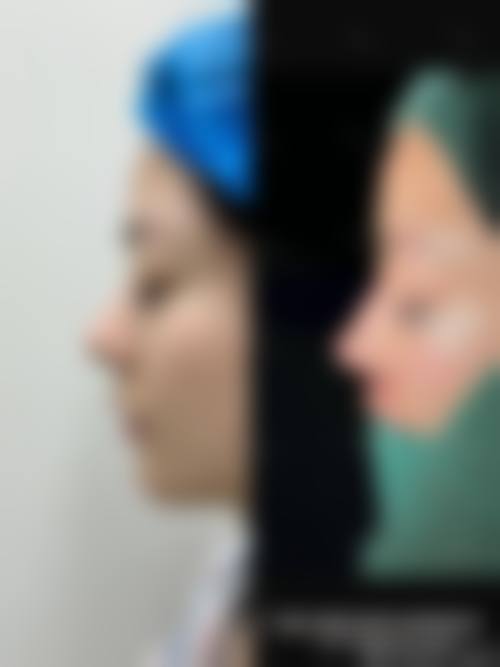 营口站前协和医疗美容门诊部收费价格表