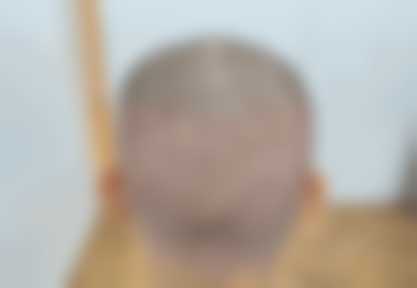 苏州维密植发(沪西医美)医生团队介绍